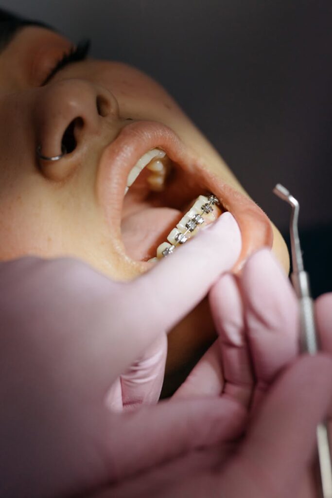 Braces Orthodontics Treatment Dentist examining patient's braces during a dental appointment.